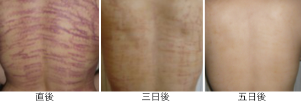 Image エンダモー参考