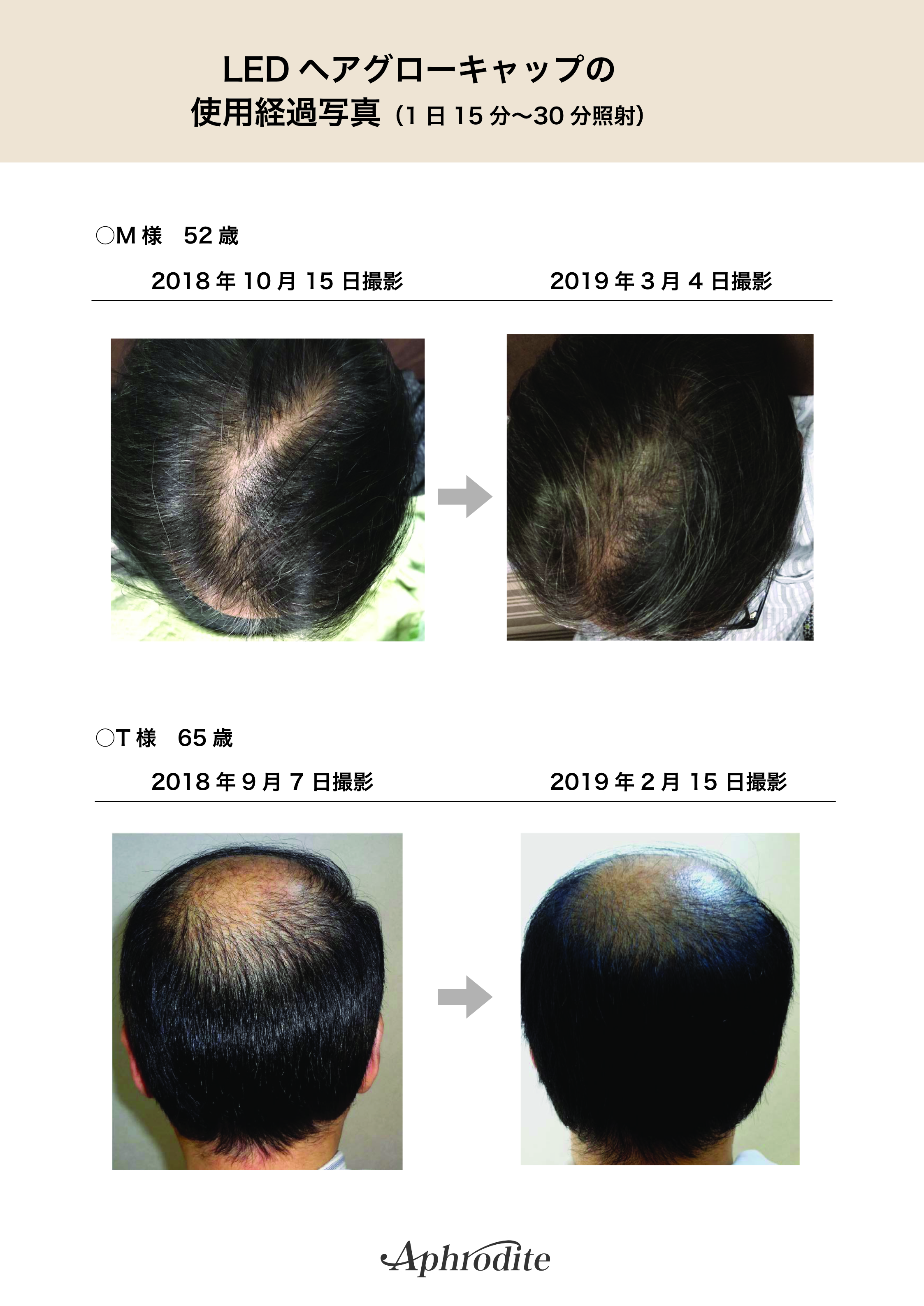 Image ヘアグロー参考画像