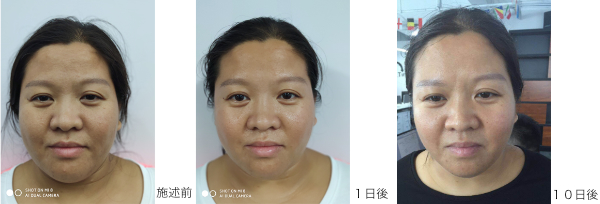 Image Face care